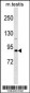 DDX4 Antibody (N-term)