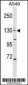 COL4A6 Antibody (Center)