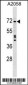 DDX56 Antibody (C-term)