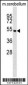 Mouse Stk11 Antibody (C-term)