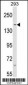 SAFB Antibody (N-term)