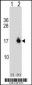 ACYP1 Antibody (C-term)