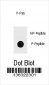 Phospho-TOPBP1(S1138) Antibody