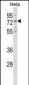 NET1 Antibody (Center)