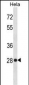 HMGB1 Antibody (C-term)