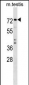 TRIM41 Antibody (C-term)