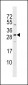 SOST Antibody (N-term)