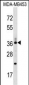 CD68/CD68 (kpi) Antibody (Center)