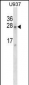 SRA1 Antibody (C-term)