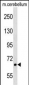 AKAP8L Antibody (C-term)