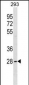 FUSIP1 Antibody (C-term)