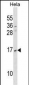 NDUFAB1 Antibody (Center)