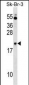 NKIRAS1 Antibody (Center)