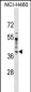 SDCCAG8 Antibody (N-term)