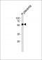 ZNF71 Antibody (N-term)