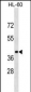 GPR32 Antibody (N-term)