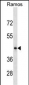 RGMB Antibody (C-term)