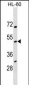 NOXO1 Antibody (Center)