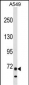 ITK Antibody (N-term)