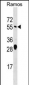 ARFGAP2 Antibody (Center)