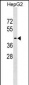 WIPI1 Antibody (Center)