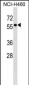 TYRP1 Antibody (Center)