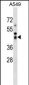 SAV1 Antibody (N-term)