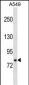 GLB1 Antibody (N-term)