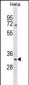 WDR4 Antibody (Center)
