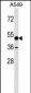 AMY1A Antibody (C-term)