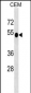 DUSP6 Antibody (N-term)