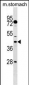 DUSP6 Antibody (N-term)