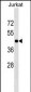 HOXC10 Antibody (Center)