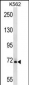 SAMHD1 Antibody (Center)