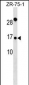TIMM9 Antibody (Center)