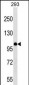 MYBL1 Antibody (Center)