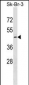 QTRT1 Antibody (C-term)
