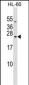 RAB20 Antibody (C-term)