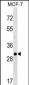 RAB26 Antibody (C-term)