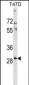 RNF138 Antibody (Center)