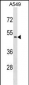 CDKL4 Antibody (C-term)