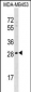 AIDA Antibody (C-term)