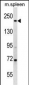 MYH7 Antibody (N-term)