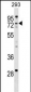 ZCCHC8 Antibody (C-term)
