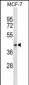 HAUS7 Antibody (N-term)