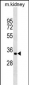 ZFP36L2 Antibody (Center)