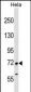 FIGNL1 Antibody (N-term)