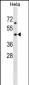 LASS6 Antibody (C-term)