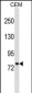 MUM1 Antibody (C-term)