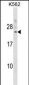 DCAKD Antibody (N-term)